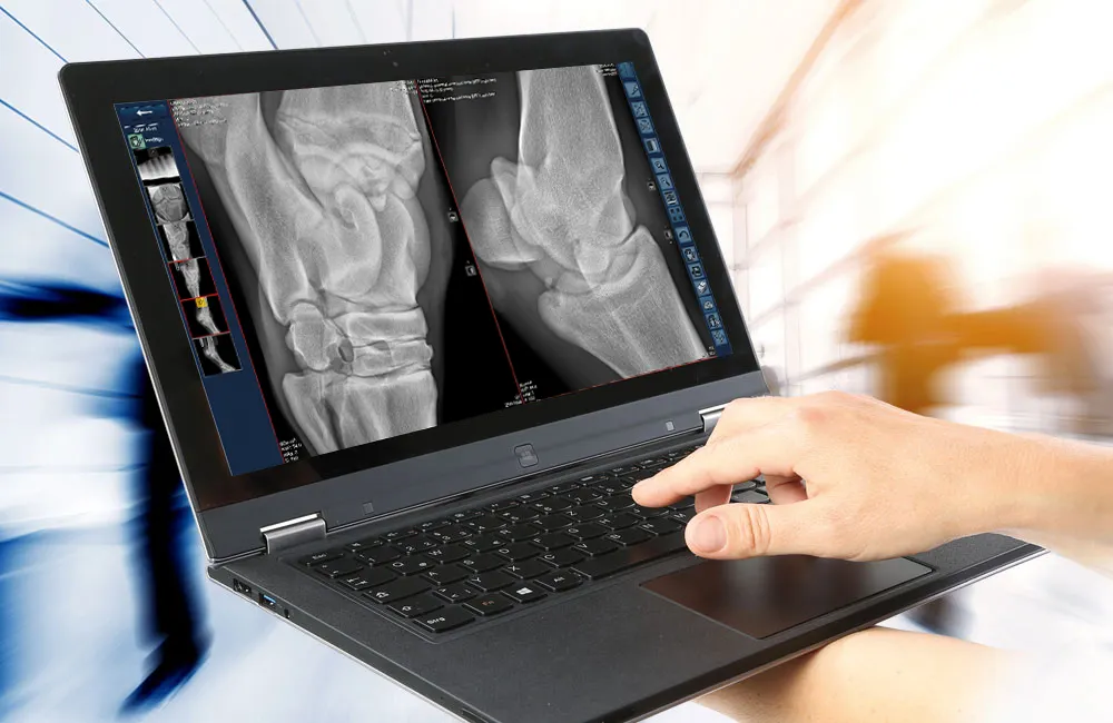 Equine knee radiograph shown on laptop