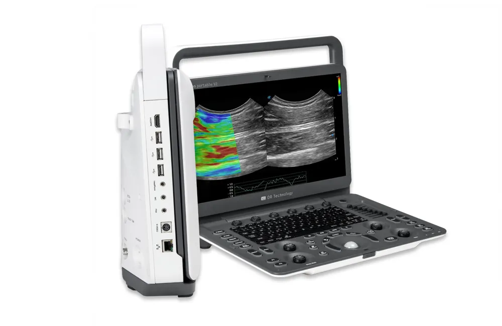 Veterinary ORsono Portable V2 ultrasound with screen and control panel opened