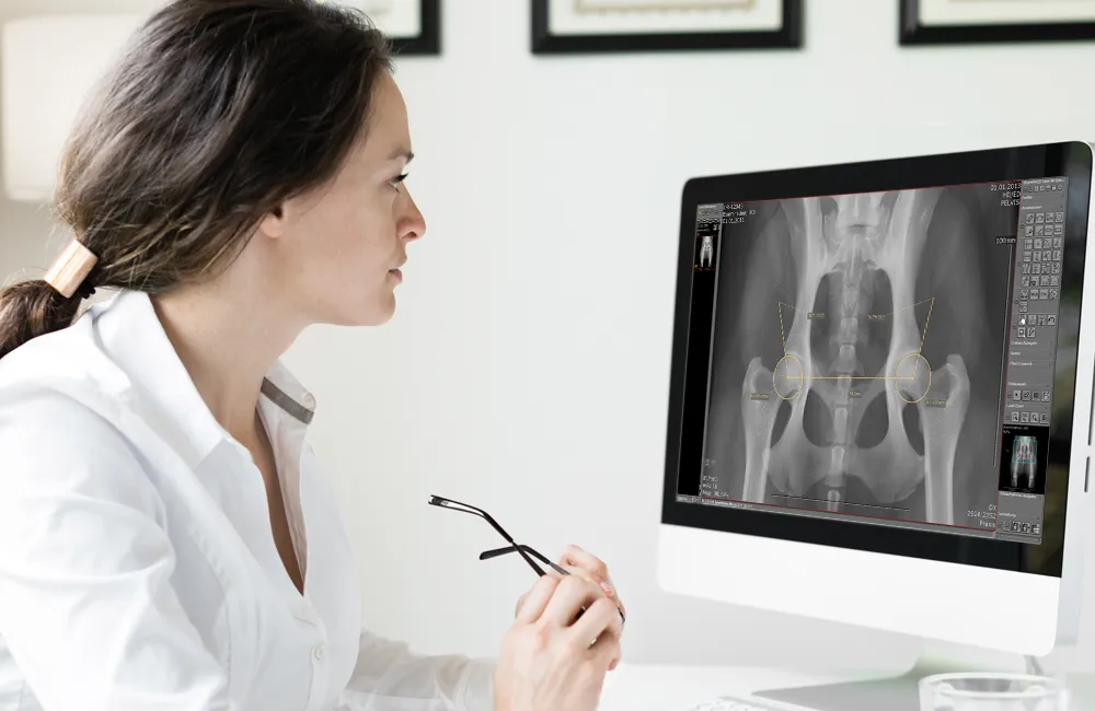 Veterinarian reviewing dog hip X-ray with AI-measured Norberg angle in dicomPACS®DX-R
