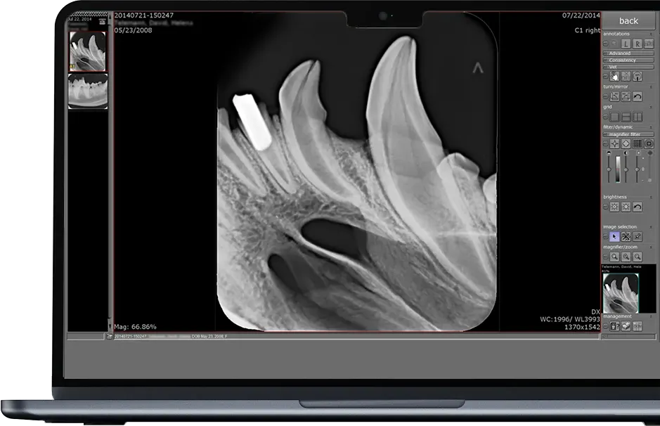 Laptop displaying dicomPACS DXR software with small animal jaw X-ray