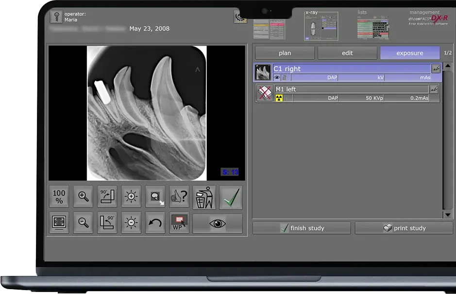 Small animal dental X-ray on laptop using veterinary dicomPACS DXR software